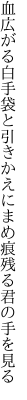 血広がる白手袋と引きかえに まめ痕残る君の手を見る