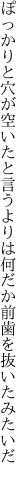 ぽっかりと穴が空いたと言うよりは 何だか前歯を抜いたみたいだ