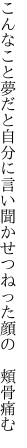 こんなこと夢だと自分に言い聞かせ つねった顔の　頬骨痛む