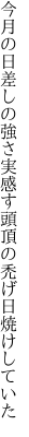 今月の日差しの強さ実感す 頭頂の禿げ日焼けしていた