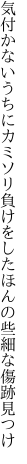 気付かないうちにカミソリ負けをした ほんの些細な傷跡見つけ