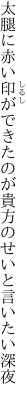太腿に赤い印ができたのが 貴方のせいと言いたい深夜