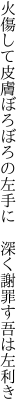 火傷して皮膚ぼろぼろの左手に  深く謝罪す吾は左利き