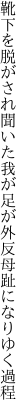 靴下を脱がされ聞いた我が足が 外反母趾になりゆく過程