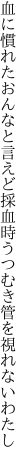 血に慣れたおんなと言えど採血時 うつむき管を視れないわたし